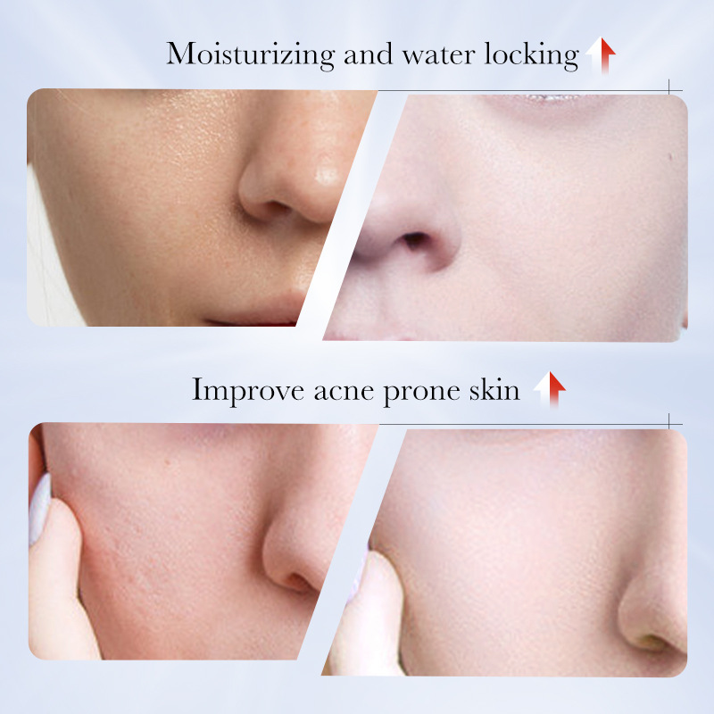 Fade Age Spots, Restore Youthful Glow BBOJI Kojic Acid Whitening & Repair Cream