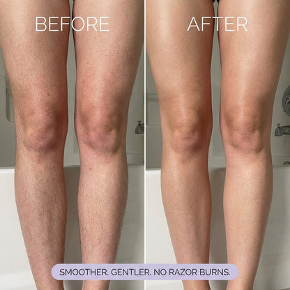 🏆 Last Day Special 🔥Buy 1 Get 1 Free🎁Full Body Hair Removal Free Scraper Gift