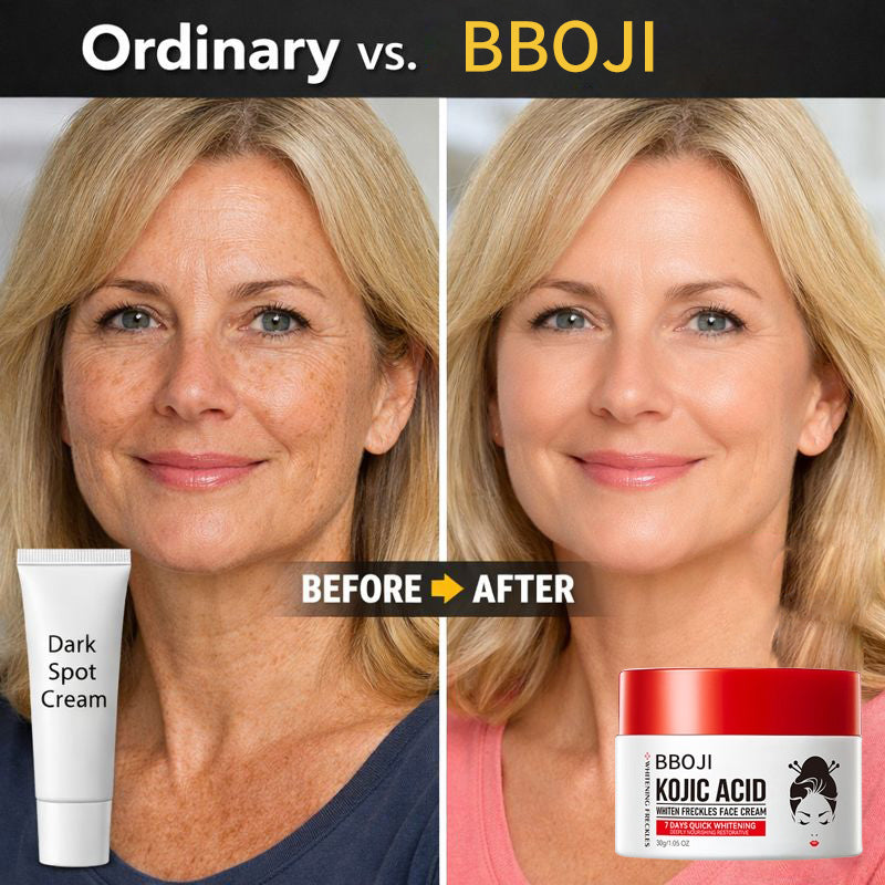 Fade Age Spots, Restore Youthful Glow BBOJI Kojic Acid Whitening & Repair Cream